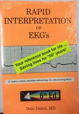 Rapid Interpretation of EKG's 6th