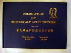 Color Atlas of Zhu's Scalp Acupuncture 1st