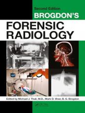 Brogdon's Forensic Radiology 2nd