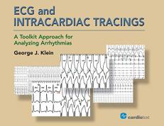 Ecg and Intracardiac Tracings : A Toolkit Approach for Analyzing Arrhythmias 